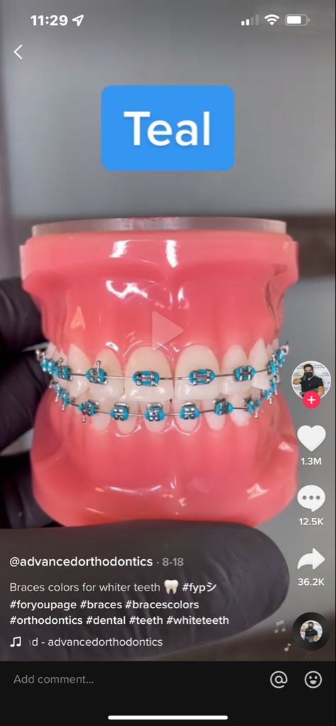 Braces Blue Color, Aqua Braces Color, Rubber Band Colors For Braces, Braces Colors On Teeth, Teal Braces For Teeth, Teeth Braces Colors, Metal Braces Colors, Teal Power Chain Braces, Braces Colors To Make Teeth Look White