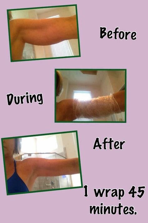 Who needs arm flab!!! Tighten Stomach, Fitness Before And After Pictures, It Works Wraps, Skin Tightening Stomach, Lose Arm Fat, Crazy Wrap Thing, Arm Fat, Body Wrap, Loyal Customer