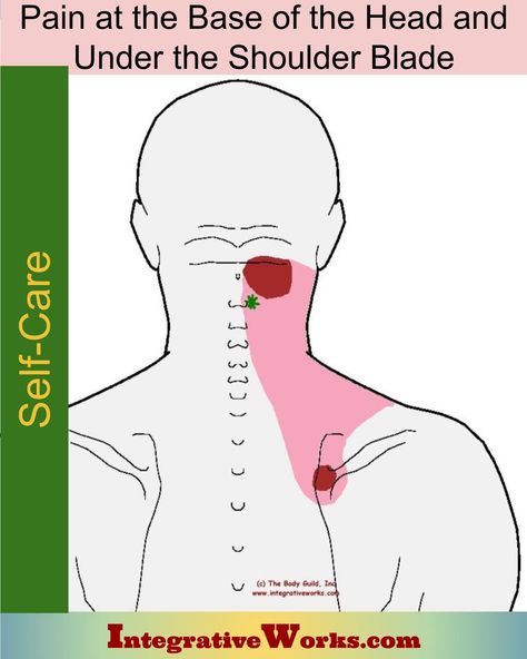 Sometimes with stif neck. Self-care including activities to change or avoid, strategies for relief, exercises for longer-lasting change, yoga, more. Shoulder Pain Remedies, Therapist Notes, Forward Head Posture Exercises, Neck And Shoulder Exercises, Sore Shoulder, Neck And Shoulder Muscles, Referred Pain, Forward Head Posture, Neck Exercises