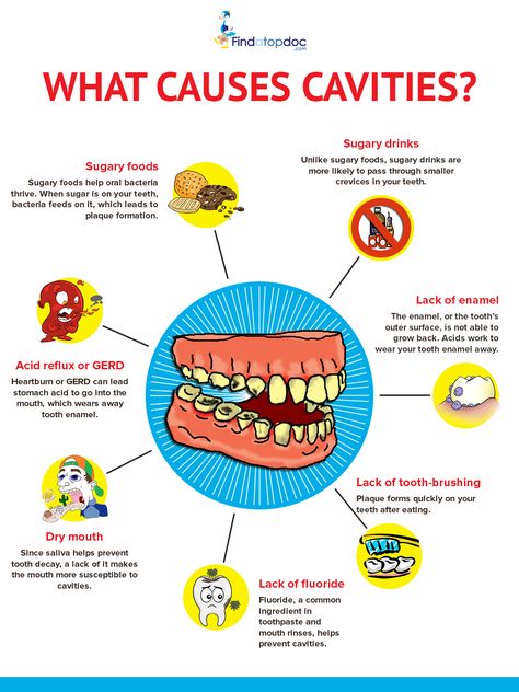 What Causes Cavities? Dental Poster, Dental Assistant Study, Oral Health Education, Dental Nurse, Dental Quotes, Teeth Tips, Dental Decay, Dental Education, Dental Posts