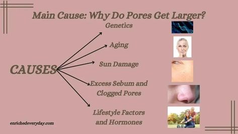 Why Are My Pores So Big? Understanding the Cause and How to Care for Large Pores #skincare #skincaretips #openpores #largepores #largeporestreatment #blogging #article #usablogger #newyork Large Pores, Clogged Pores, Skin Care Tips, Blogging, Quick Saves