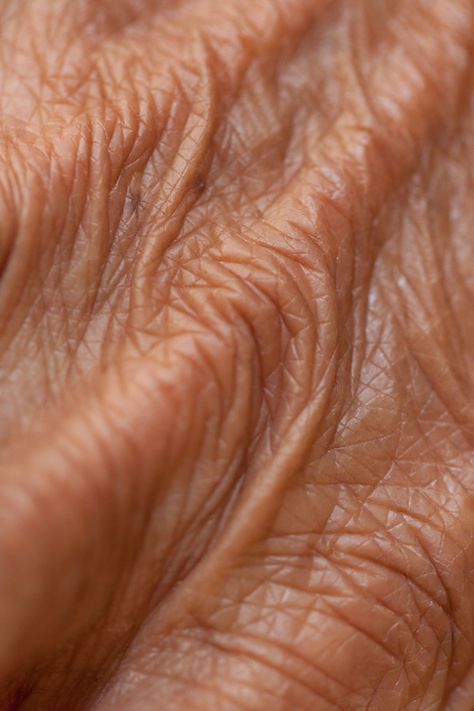 Your Flesh by Jacqueline Bernal, via Behance - close up macro shots can tell a story and give secrets of a persons identity (scars, wrinkles, blemishes etc.) they can show what the person has been through, what has formed them. Wrinkles Photography, Foto Macro, Losing 40 Pounds, Home Remedy For Cough, Cold Sores Remedies, Natural Sleep Remedies, Natural Cold Remedies, Texture Photography, Macro Shots