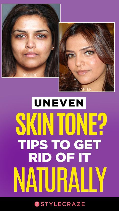 Even Tone Skin Diy, How To Get Even Skin Tone On Face Naturally, Tips For Even Skin Tone, Best Skin Care Products For Uneven Skin Tone, Skincare Routine For Uneven Skin Tone, Diy Face Mask For Even Skin Tone, How To Even Your Skin Tone, Face Mask For Even Skin Tone, Remedy For Uneven Skin Tone