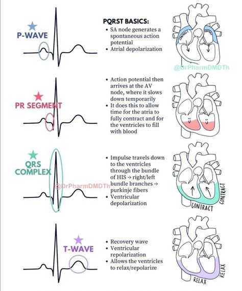 Ekg Rhythms, Nursing School Prep, Nursing School Studying Cheat Sheets, Emt Study, Ekg Interpretation, Medical Assistant Student, Paramedic School, Nursing School Essential, Nurse Study