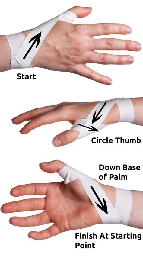 Thumb Spica Taping Step 2 | Physical Sports First Aid Athletic Training Sports Medicine, K Tape, Kinesio Taping, Sports Therapy, Volleyball Workouts, Volleyball Training, Kinesiology Taping, How To Wrap, Trening Fitness