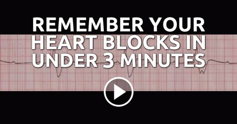 Heart blocks can be a very difficult subject to memorize. You have sat there for hours trying to memorize heart blocks and now you find it hard to believe you can just memorize this in three minutes. Nursing Cardiac, Nclex Tips, Medical Assistant Student, Heart Blocks, School Nursing, Cardiac Nursing, Critical Care Nursing, Nursing Life, Nurse Rock