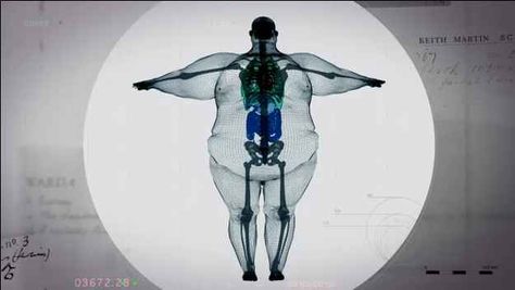 This image of an apparent X-ray of a 70-stone (980-pound) man has gone viral after trending heavily on Twitter . | This Is What A 980-Pound Man Looks Like On The Inside Big Boned, Normal Weight, Respiratory Therapy, Pisco, X Ray, Plastic Surgery, Motivation Inspiration, Take Care Of Yourself, Radios