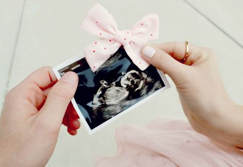 Instagram Gender Reveal Photo, Gender Reveal Social Media Photo Ideas, Gender Reveal Shoot, Gender Reveal Photoshoot With Siblings, Gender Announcement Pictures, Gender Reveal Photoshoot Ideas, Girl Gender Announcement, Foto Gender Reveal, Gender Reveal Photo Ideas