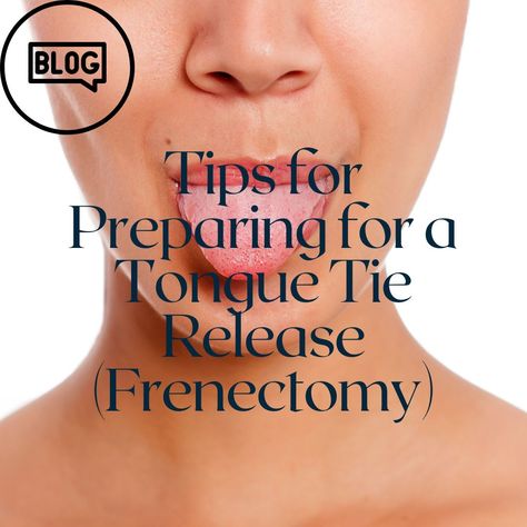 Tips For Preparing For a Tongue Tie Release Tongue Thrust, Myofunctional Therapy, Mouth Breathing, Neck Tension, Crooked Teeth, Poor Digestion, Jaw Pain, Tongue Tie, Surgery Recovery