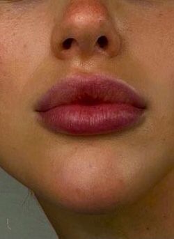 Perfect Lips Aesthetic, Heart Makeup Aesthetic, Ideal Lips, Remove Upper Lip Hair Naturally, Remove Upper Lip Hair, Big Lips Natural, Heart Shaped Lips, Lips Inspiration, Upper Lip Hair