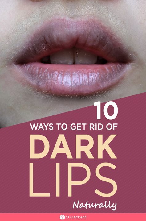 10 Proven Ways To Get Rid Of Dark Lips Naturally – Worked For 99% People Who Tried: Apart from using expensive lip scrubs and peels, you can make some easy lip packs yourself to remove the dark and ugly pigmentation. Here are some tips and recipes you should follow to lighten your dark lips. #Beauty #BeautyTips #Lips #LipCare #DarkLips #Remedies Remedies For Dark Lips, Watermelon Lip Scrub, Honey Lip Scrub, For Dark Lips, Natural Pink Lips, Natural Lip Scrub, Lip Lightening, Throbbing Headache, Lip Scrub Recipe