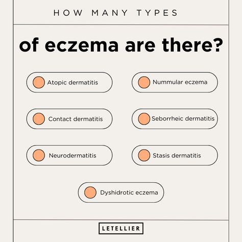 There are 7 different types of eczema: 

✔ Atopic dermatitis
✔ Contact dermatitis
✔ Neurodermatitis
✔ Dyshidrotic eczema
✔ Nummular eczema
✔ Seborrheic dermatitis (Usually affects the scalp)
✔ Stasis dermatitis

❗It’s possible to have more than one type of eczema at the same time. 

❗Dermatologists can help identify which types of eczema you may have and how to treat and prevent flare-ups.

Tag @ someone who suffers from eczema. Master Esthetician, Kids Skin Care, Healthy Makeup, Feel Healthy, Clean Cosmetics, Plant Based Skincare, Age Gracefully, Clearer Skin, Sensitive Skin Care