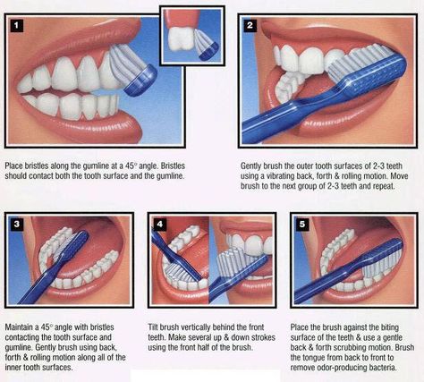 Brushing technique: Bass and Modified Bass Methods ~ MedchromeTube - Best Medical Videos Natural Teeth Whitening Diy, Dental Education, Dental Health Month, Dental Assisting, Dental Hygiene School, Dental Tips, Teeth Whitening Diy, Brush Teeth, Dental Facts