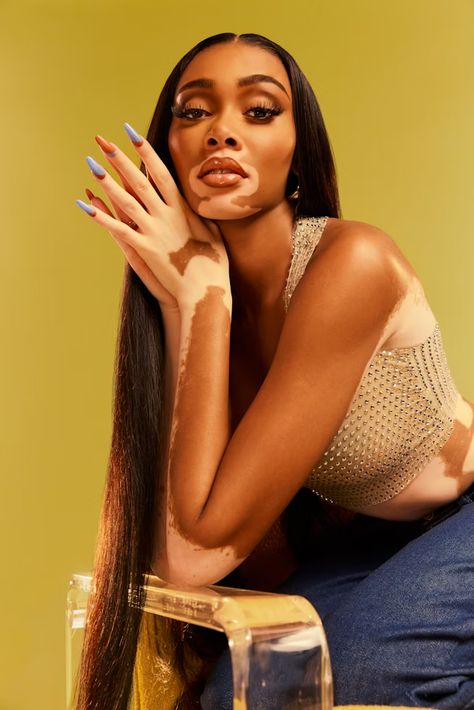 Winnie Harlow Used To Want To Be A Beautuber Winnie Harlow Instagram, Drawing From Reference, Venus Virgo, I Accept Myself, Accept Myself, Character Mood Boards, Stuff To Print, Faces To Draw, Film Character