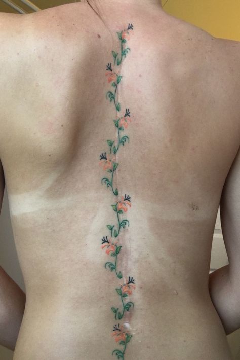 Surgery Tattoo, Floral Spine Tattoo, Honeysuckle Flowers, Spinal Tattoo, Flower Spine Tattoos, Tattoo Over Scar, Spine Tattoo Ideas, Scar Cover Up, Back Tats