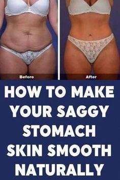 Sagging Belly, Flabby Stomach, Tighten Stomach, Sagging Cheeks, Loose Belly, Tighten Loose Skin, Fitness Pal, Best Fat Burning Foods, My Fitness Pal