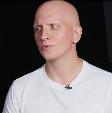 Noho Hank, Alopecia Universalis, Anthony Carrigan, Victor Zsasz, Male Reference, Special Effect, Bald Heads, My Bf, Gotham