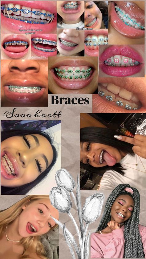 Iii loveee the pinkkk oneee😍 Cute Braces Colors Combinations, Braces Black Women, Braces Color Combos, Dream Teeth, Brace Ideas, Braces Colors Combinations, Braces Colours, Braces Ideas, Dental Appliance