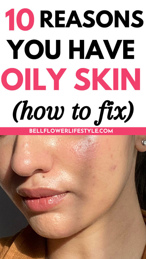 10 reasons you have oily skin - how to fix How To Make Your Skin Less Oily, What To Do With Oily Skin, Natural Remedies For Oily Skin, Skin Care Regimen For Oily Skin, How To Get Rid Of Greasy Skin, How To Make Skin Less Oily, How To Control Oil On Face, Daily Face Care Routine Oily Skin, How To Remove Oily Skin