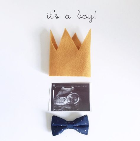 Gender Announcement Ideas Creative Gender Reveals, Gender Reveal Photos, Vogue Kids, Gender Announcements, Idee Babyshower, Baby News, Foto Baby, Foto Tips, Gender Reveal Ideas