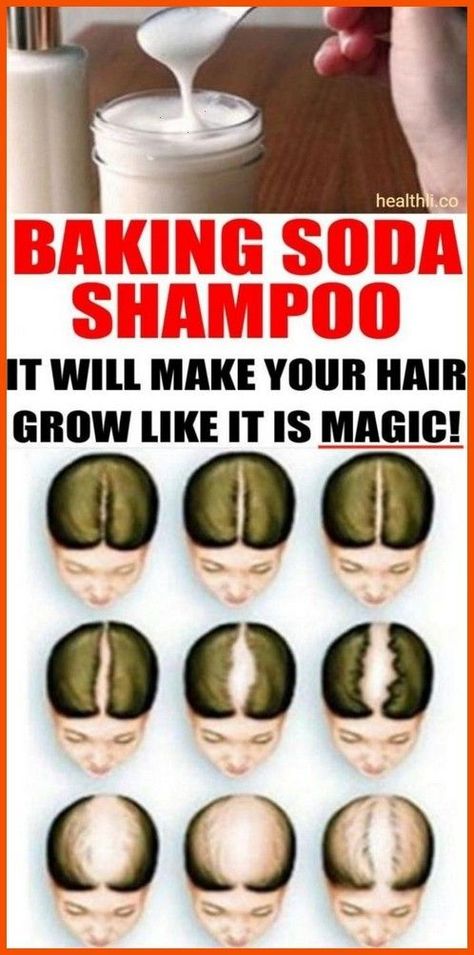 Baking Soda Shampoo: It Will Make Your Hair Grow Like It Is Magic! Relieve Gas, Healthy Natural Hair Growth, Shampoo Brands, Baking Soda Uses, Baking Soda Shampoo, Healthy Natural Hair, Beauty Regimen, Different Hair, Wallpaper Vintage