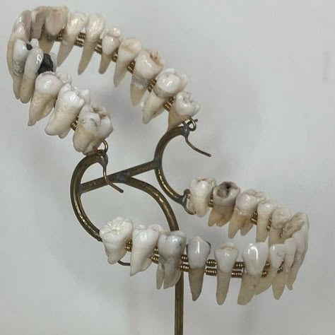 Chipped Teeth Aesthetic, Types Of Teeth Shapes, Gold Teeth Aesthetic, Teeth Photography, Clay Teeth, Teeth Collection, Teeth Aesthetic, Chipped Tooth, Teeth Art