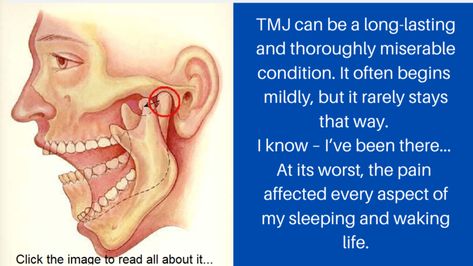 How 4 TMJ Relief Exercises Quickly Treat Jaw Pain Causes and Symptoms - Be Your Best, Well, Self Tmj Relief Remedies, Healing Quotes Health, Jaw Pain Relief, Tmj Symptoms, Tmj Relief, Mthfr Gene Mutation, Gene Mutation, Mthfr Gene, Mouth Care