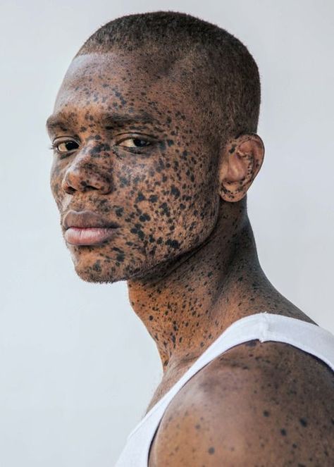 Unusual Faces Unique, Freckled Model, Men Freckles, Unique Models Faces, Unique Faces Woman, Unique Faces Men, Aris Jerome, Unusual Faces, Guy Face