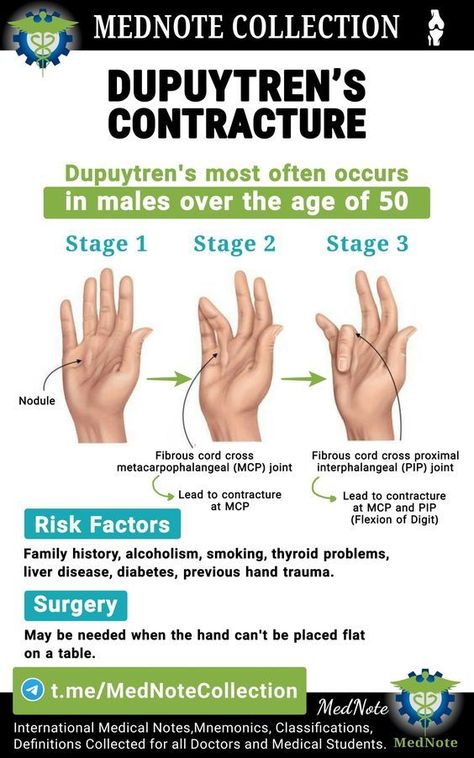 Dupuytren's Contracture, Summer Health Tips, Medical Terminology Study, Blood Sugar Level Chart, Nursing Mnemonics, Summer Health, Medical Posters, Blood Sugar Diet, Musculoskeletal System