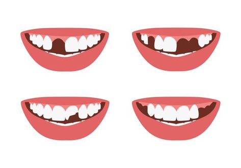 Smile Tips, Teeth Aesthetic, Molar Tooth, Dental Health Care, Missing Teeth, Smile Teeth, Fashion Graphic Design, First Tooth, Fashion Graphic