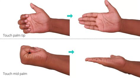 5 Easy Dupuytren's Contracture Exercises for Finger Pain Relief 4 Dupuytren's Contracture, Daily Routine Ideas, Hand Therapy, Routine Ideas, Medical Information, Daily Routine, Pain Relief, Disease, Medical