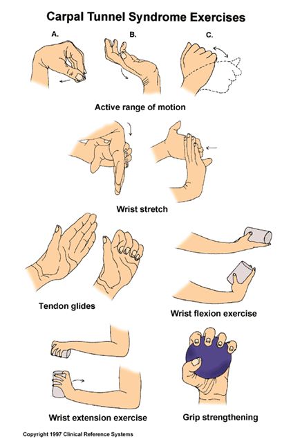 Carpal Tunnel Relief Exercises, Carpal Tunnel Remedies, Hand Therapy Exercises, Carpal Tunnel Exercises, Carpal Tunnel Surgery, Carpal Tunnel Relief, Wrist Exercises, Occupational Therapy Activities, Physical Therapy Exercises