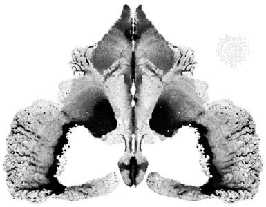 Ink Blot Test, Ink Blot Art, Rorschach Art, Rorschach Inkblot Test, Inkblot Test, Rorschach Inkblot, Rorschach Test, Opening Credits, Ink Blot