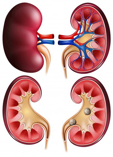 Kidney Specialist, Human Brain Diagram, Importance Of Sports, Importance Of Drinking Water, Kidney Anatomy, Brain Diagram, Human Kidney, Polycystic Kidneys, Healthy Kidneys