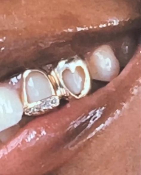 Partial Teeth Grills, Wedding Grills Teeth, Small Grills Teeth, Gold Grillz For Females, Couples Grillz, Grillz On Women, Silver Grillz Black Women, Mouth With Grills, Women’s Grills