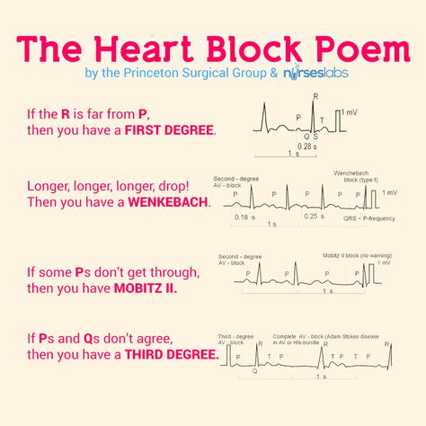 The Heart Block Poem  For more mnemonics, visit our site! http://nurseslabs.com Nursing Mnemonics, Nursing School Survival, Cardiac Nursing, Critical Care Nursing, Heart Blocks, Nursing School Studying, Nursing School Tips, Nursing School Notes, Nursing Tips