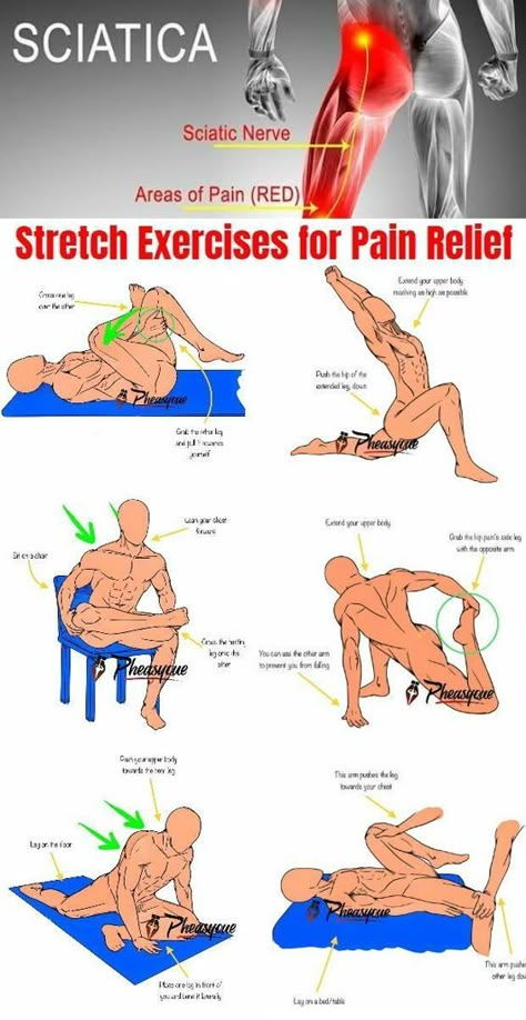 Stretching Sciatic Nerve, How To Strengthen Sciatic Nerve, Exercises For Sciatic Nerve Pain Sciatica Stretches, Ciatica Stretches Sciatic Pain, Ciatica Pain Relief, Back And Hip Stretches, Stretches For Sciatic Nerve Pain, Pinched Nerve In Lower Back, Sciatic Stretches