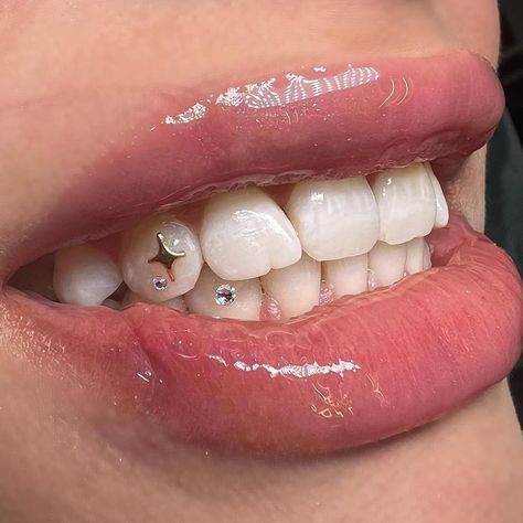 Tooth Gem Ideas, Teeth Gems, Pretty Teeth, Dental Jewelry, Grillz Teeth, Diamond Teeth, Diy Teething, Inexpensive Jewelry, Grills Teeth