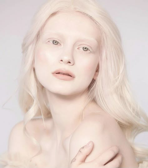 #albinogirl #albino #albinism #whitehair #white Albino Girl, Angels Beauty, Targaryen Aesthetic, Face References, Arte Fantasy, Skin Conditions, Oc Ideas, Drawing People, White Hair