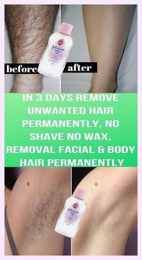 I’m so grateful I get to be here. Laudable info! Best Permanent Hair Removal, Electrolysis Hair Removal, Hair Removal Spray, Unwanted Hair Permanently, Best Hair Removal Products, Remove Unwanted Hair, Underarm Hair Removal, Painless Hair Removal, Sugar Waxing