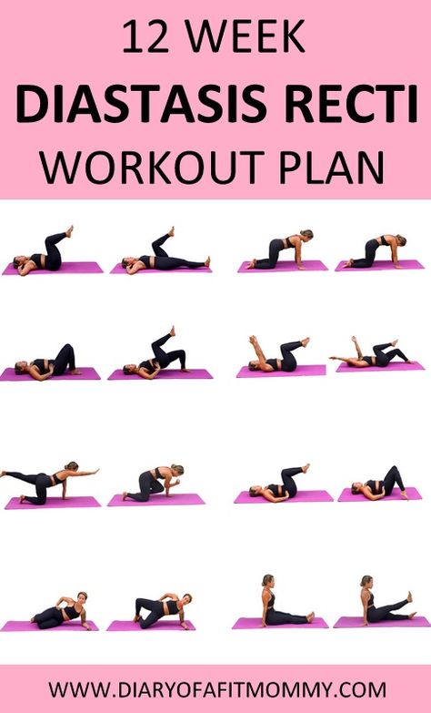 Yoga Diastasis Recti, Core Workouts For Diastis Recti, Week 1 Workout Plan, Exercises For Post Partum Belly, Diastasis Recti Core Exercises, Post Partum Core Workout At Home, Ab Workouts Diastasis Recti, Diastis Recti Exercises Workout Plan, Diary Of A Fit Mommy Diastasis Recti