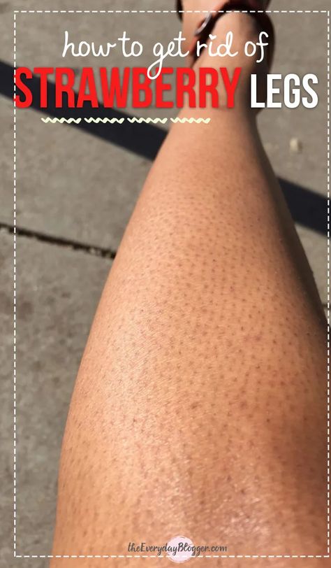 How to Get Rid of Strawberry Legs Obličejové Masky, Coffee Facial, Strawberry Legs, Glowing Radiant Skin, Skin Care Routine For 20s, Home Remedies For Hair, Natural Therapy, Skin Complexion, Natural Beauty Tips