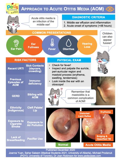 Acute Otitis Media | PedsCases Otitis Media Nursing, School Knowledge, Patient Assessment, Ear Nose Throat, Medical Notes, Natural Face Cleanser, Middle Ear, Pa School, Ear Infections