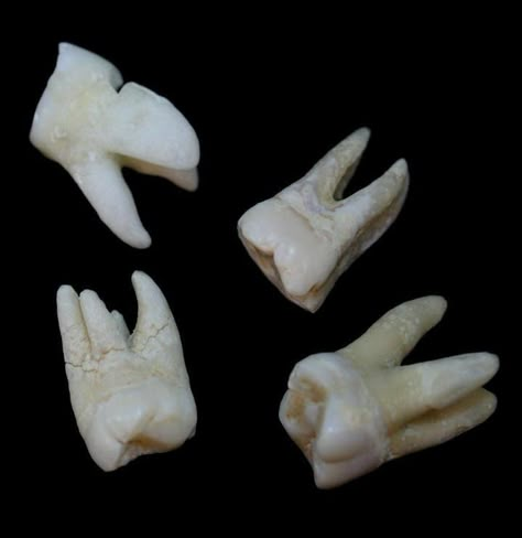 Bone Anatomy, Wizard Frog, Teeth Aesthetic, Decay Art, Molar Tooth, Tooth Whitening, Human Teeth, Wisdom Teeth, Harvest Moon