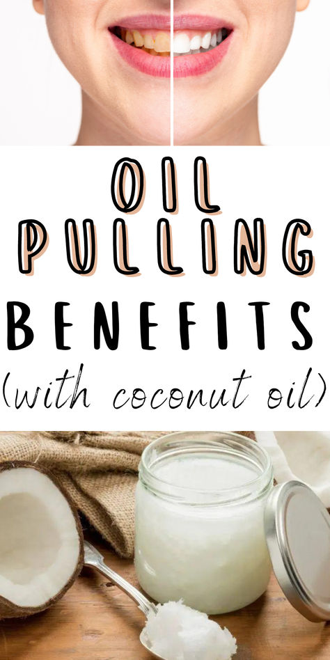 Oil Pulling Benefits (with Coconut Oil) Coconut Oil Pulling Benefits, Benefits Of Oil Pulling, What Is Oil Pulling, Health Coconut Oil, Oil Pulling Benefits, Best Coconut Oil, Coconut Oil For Teeth, Coconut Oil For Acne, Coconut Oil Skin Care