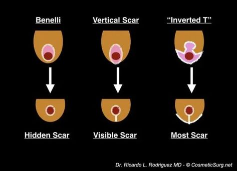 Breast lift scar options - Ricardo L. Rodriguez MD, Baltimore Human Avatar, Face Procedures, Breast Lift Surgery, Laser Skin Resurfacing, Facial Fillers, Lip Augmentation, Neck Lift, Botox Injections, Skin Resurfacing