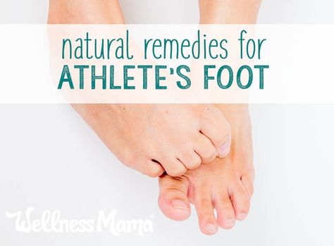 No one likes athlete's foot. Learn 5 effective natural remedies that are easy to make with ingredients you probably already have at home. Healing Cavities, Sagging Skin Remedies, Natural Add Remedies, Remedy For Cold, Inflammation Remedies, Cramp Relief, Wellness Mama, Athletes Foot, Diy Remedies