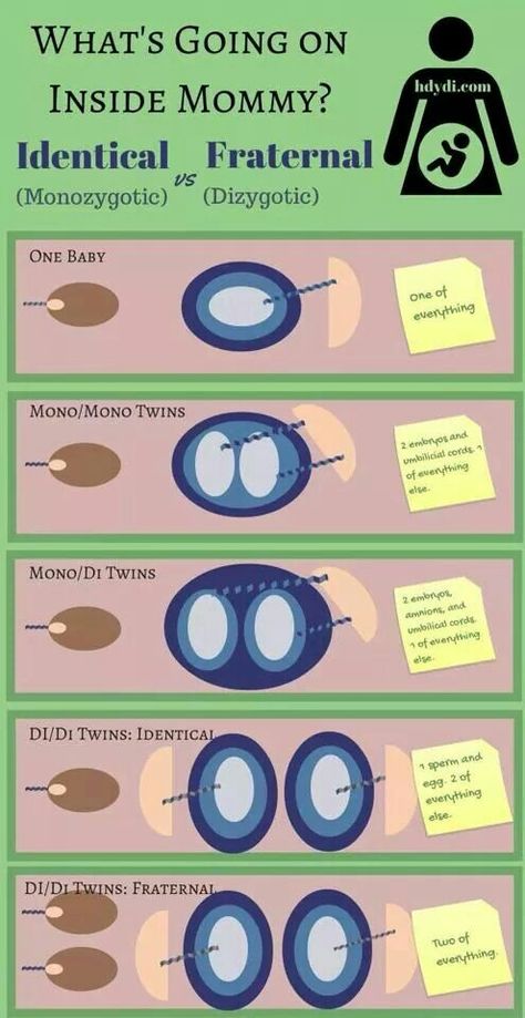 Im mono/di :) identical girls!!! Twin Ultrasound, Twins In The Womb, Twins Ultrasound, Types Of Twins, Basic Science, Raising Twins, Having Twins, Fraternal Twins, Twin Life