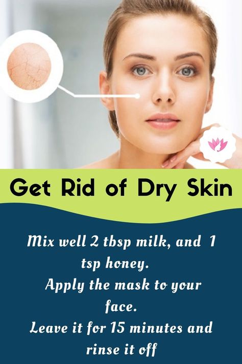 Best Face Masks For Dry Skin, How To Get Rid Of Dry Skin, Dry Face Remedy, Dry Skin Remedies For Face, Dry Skin Face Mask, Get Rid Of Dry Skin, Dry Skin Diy, Living Naturally, Messi Wallpapers