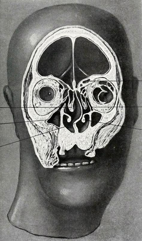 Structural anatomy of the human head. Successive frontal slices of adult male, brain removed - 3/7. Studies in the Anatomy and Surgery of the Nose and Ear. Adam E. Smith, 1918. Body Horror, Human Head, Vintage Medical, Arte Inspo, Scientific Illustration, Medical Illustration, Anatomy Drawing, Ap Art, Anatomy Reference